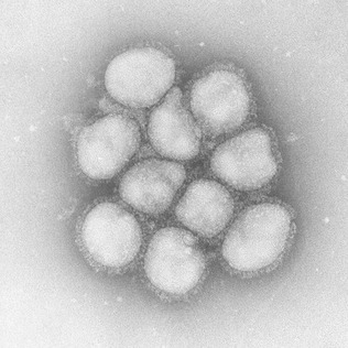 インフルエンザＡ型のウイルス（国立感染症研究所提供）