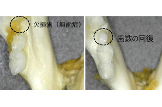 「歯生え薬」の治験開始へ＝３０年の実用化目指す―北野病院など