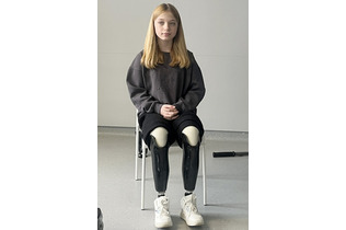 両足失った少女、マラソン挑戦＝医療施設「不屈」でリハビリ―ウクライナ