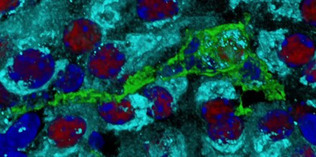 顕微鏡で撮影した、膵臓（すいぞう）のベータ細胞（赤色）を食べるマクロファージ（緑色）（東北大提供）