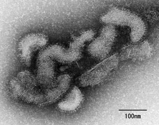 オズウイルスの電子顕微鏡写真（国立感染症研究所提供）