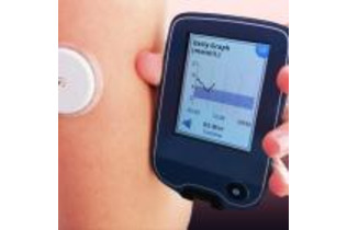 アプリで糖尿病予備軍の血糖変動が改善