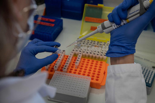 仏リヨンの研究所で、ヒトゲノム解析の準備をする研究者＝２０２２年２月（ＡＦＰ時事）（資料）