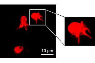 肺や皮膚にリンパ球系樹状細胞＝マウスで多く存在、適度な免疫担う―ヒトで解明目指す・東京科学大など
