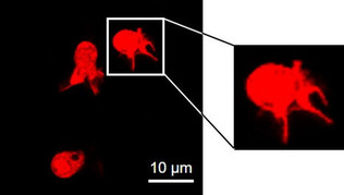 マウスで見つかったリンパ球系の樹状細胞(赤い蛍光で識別)。この画像は脾臓(ひぞう)だが、肺や皮膚で多いと分かった(金山剛士・東京科学大准教授提供)
