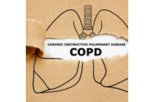 吸入ステロイドでCOPDの骨折リスク上昇
