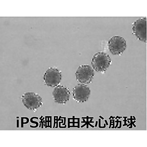 順天堂医院での治験1例目のiPS細胞由来心筋球治療を実施いたしました