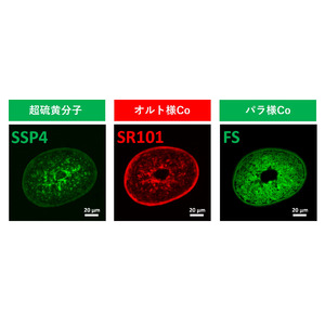 新たな結合『超硫黄分子』、コルテックスとメデュラでの存在を確認