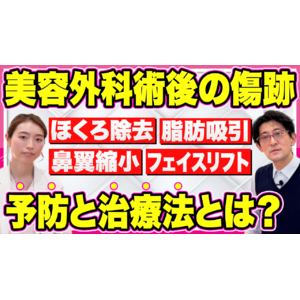 美容外科手術（美容整形手術）後の傷跡に対するモニター募集【2024年3月31日まで】