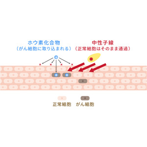 株式会社CICS（リゾートトラスト株式会社の連結子会社） BNCTの特定臨床研究に関する契約を江戸川病院と締結　～FDG-PET陽性の浅在性腫瘍に対する研究にBNCT用装置に関する技術を提供～