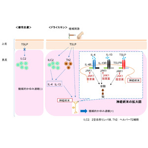 JAK阻害薬に機械的かゆみの即時的な治療効果があることを発見