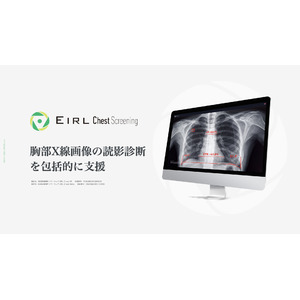 胸部X線画像の読影診断を支援するEIRL Chest Screeningの新モデルを発売、過去検出結果比較機能を追加し、比較読影支援を可能に
