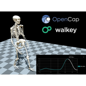 スタンフォード大発のAI筋骨格解析技術を活用し、歩行分析システムを共同開発。(株)walkey