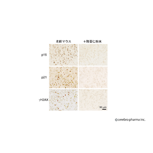 漢方薬素材「酸棗仁」に認知症を予防し脳を若返らせる作用を発見