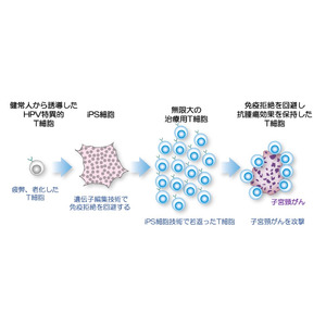 順天堂大学発「子宮頸がんに対するiPS細胞由来CTL療法の医師主導治験」開始のお知らせ