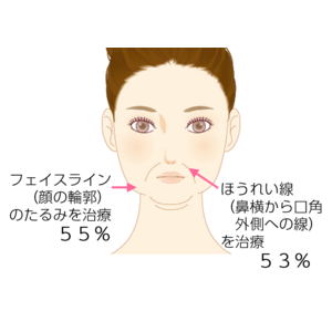 たるみ治療、何をした？効果はあった？意外!? 満足度1位は “ボトックス” 。７４％が「受けてよかった」