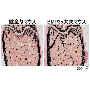 骨代謝における骨形成タンパク質BMP3bの機能を解明