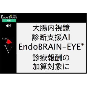 大腸内視鏡診断支援AI「EndoBRAIN-EYE(R)」が診療報酬の加算対象に