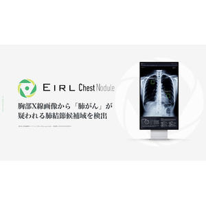 胸部X線画像から「肺がん」が疑われる肺結節候補域を検出する医用画像解析ソフトウェア「EIRL Chest Nodule」、IDATEN制度を活用し、検出感度を向上させた新モデルをリリース