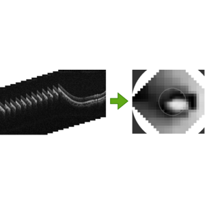 自治医科大学発ベンチャー・DeepEyeVision、AIを活用した緑内障診療の精度向上に向けた研究開発に着手