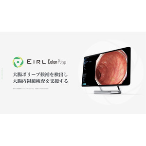大腸内視鏡診断支援AI「EIRL Colon Polyp」が診療報酬の加算対象に