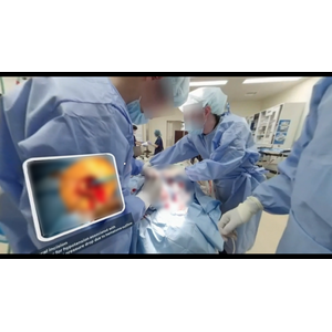 脳神経外科教育への360度実写VR活用に関する論文がCureus誌に掲載