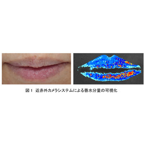 資生堂、唇表面における水分量の可視化・定量化に成功　～高いスキンケア効果を併せ持つ口紅など高付加価値の提供を実現する技術～
