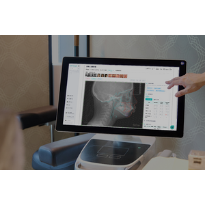 クラウド型AIセファロ分析支援システム「DIP Ceph PRO」正式リリース