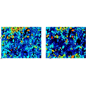 【ファンケル】生きた細胞内のタンパク質発現量を推定するAI技術を開発