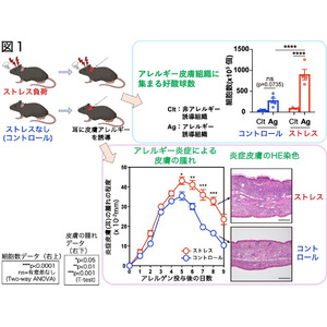 精神的ストレスがアトピー性皮膚炎を悪化させるメカニズムを解明