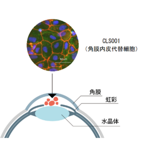 （株）セルージョン　CLS001が水疱性角膜症に対するFDAの希少疾病用医薬品指定を取得