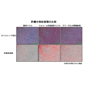 【摂南大学】水溶性食物繊維 ”グアーガム分解物” のアルコール性脂肪肝の改善効果を解明