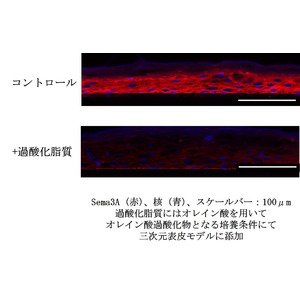 皮脂の酸化が頭皮のかゆみの一因となるメカニズムを確認