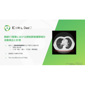 胸部CT画像から「肺がん」が疑われる肺結節候補域の検出を支援するEIRLChest CT、薬事承認を取得し販売開始