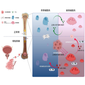 前立腺がんの骨転移を悪化させる仕組みを解明 ～破骨細胞からの“メッセージ”が鍵に～