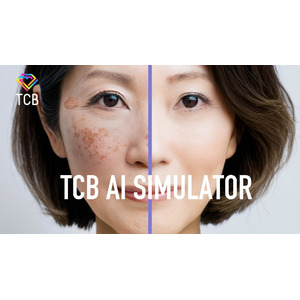TCB東京中央美容外科の新テレビCM「TCB AIエイジングケア シミ取り」篇 　6月11日(水）より全国でオンエア開始