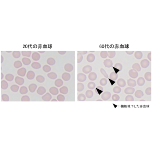 加齢に伴う疲れやすさに赤血球の機能低下が関与することを発見