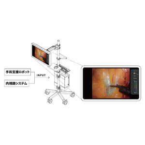 AI視覚支援手術、国内で初めて*実施