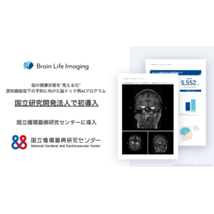 【国立研究開発法人で初導入】脳の健康状態を“見える化”。認知機能低下の予防に向けた脳ドック用AIプログラム「Brain Life Imaging(R)」を国立循環器病研究センターで導入