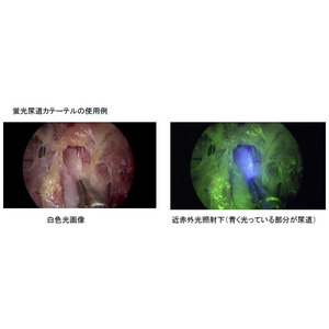 国立がん研究センター東病院とカーディナルヘルス株式会社の共同研究により開発した近赤外光照射下で蛍光反応を示す尿道カテーテルが医療機器として承認されました