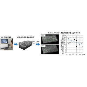 非侵襲的に皮膚内部の幹細胞の加齢変化を捉えることに成功