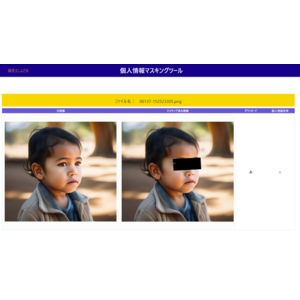 インフォメーション・ディベロプメント、AIを活用した医療画像のマスキング化ソフトウェアを慶應義塾大学病院で運用開始