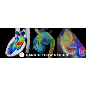 血流解析(TM)を行うCardio Flow Designが文科省研究機関認定