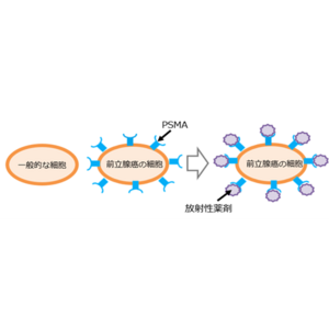 ＼　関東初導入！　／前立腺がんの診断にPSMA-PET導入でより正確な診断が可能に！