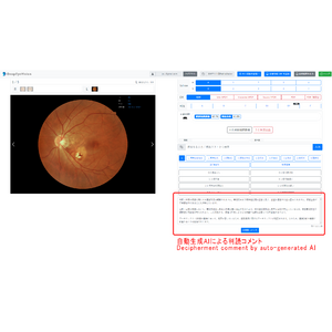 自治医科大学とDeepEyeVision、LMM（大規模マルチモーダルモデル）による眼底読影所見の自動生成機能を構築