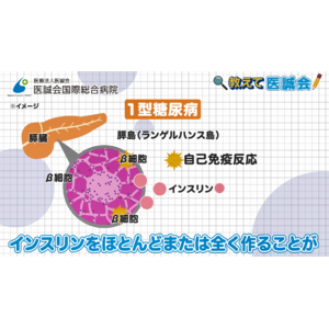 1型糖尿病について糖尿病の専門医が解説する動画を投稿/教えて医誠会