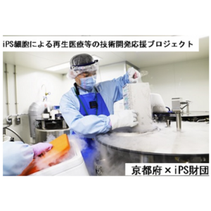 京都府とふるさとチョイス、ふるさと納税制度を活用したガバメントクラウドファンディング(R)で、iPS細胞による再生医療等の技術開発応援プロジェクトを開始
