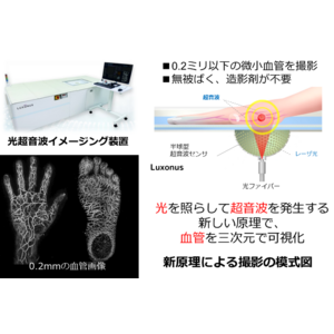 光超音波画像診断装置を開発する株式会社Luxonus「第６回日本医療研究開発大賞『スタートアップ奨励賞』」を受賞