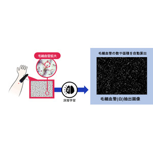 1000本以上の皮膚毛細血管を一度に可視化し定量化する新技術