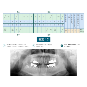 エックス線画像を用いた歯科健診サービスについて